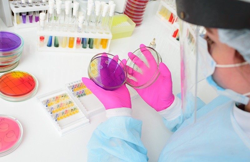 Petri dishes in the bacteriological laboratory.2019-nCoV; coronavirus; China;